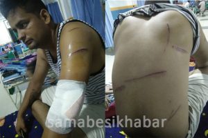 खुकुरी प्रहारबाट चितवनमा एकजना घाइते