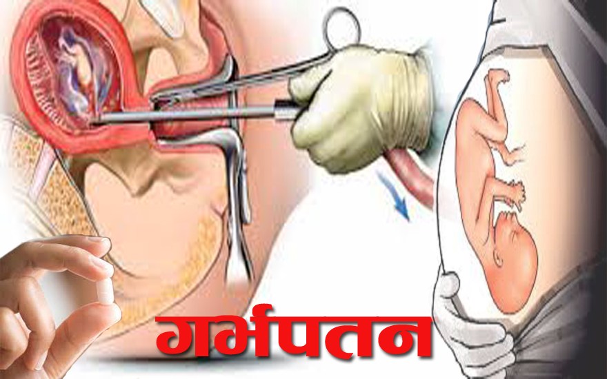 The number of women seeking safe abortion is increasing in Darchula