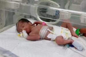 इजरायली हमलामा मारिएकी महिलाको गर्भबाट जीवित बच्चा निकालियो
