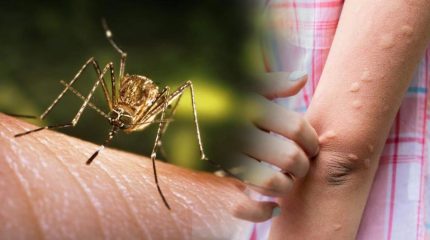 चितवनमा जापानिज इन्सेफ्लाइटिसबाट पाँच महिनामा ६ जनाको मृत्यु